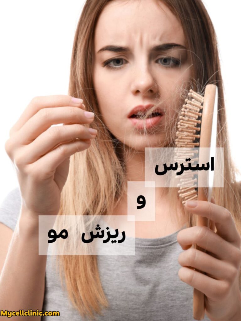 استرس و ریزش مو